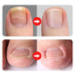🔥Hot Sale🔥Professional Ingrown Toenail Clipper 7-Piece Set