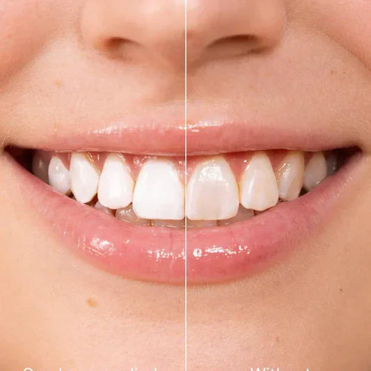 🏆Flash Sale⚡ 50K+ SOLD! 🔥5ml Instant Whitening Tooth Paint