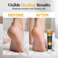 🔥HOT SALE💞50K+ SOLD!⏳✨Moisturizing Anti-Crack Repair Foot Cream