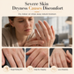 🎉Limited Sale 50%OFF🎉Moisturizing Hydrating Hand Cream for Dry Cracked Skin